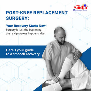 Post Knee Replacement Surgery | Dr. Nitin Srivastava